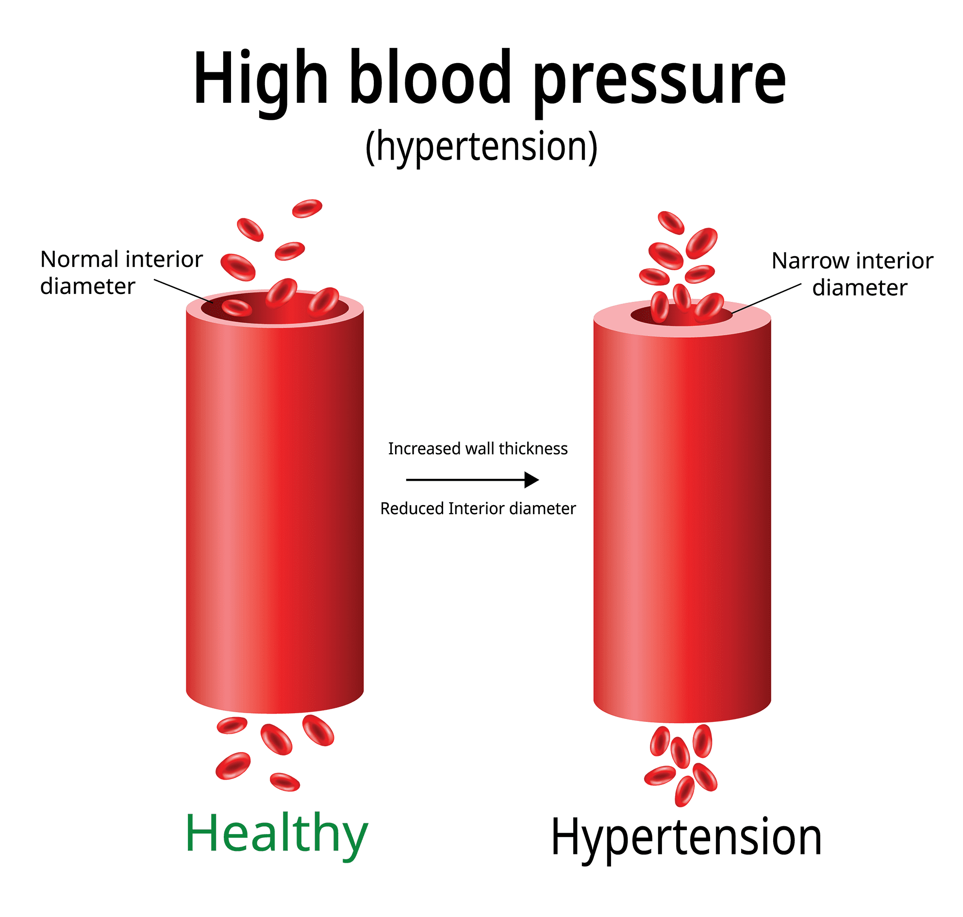 which blood pressure is normal