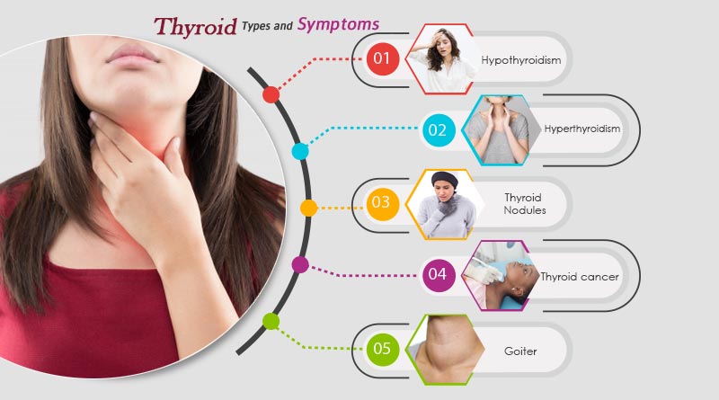 what are the symptoms of thyroid