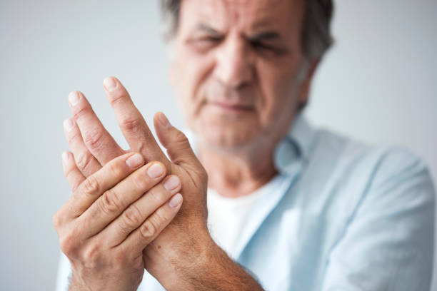 Rheumatoid arthritis medication