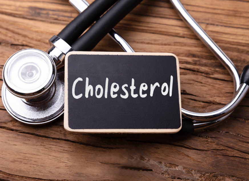 symptoms of high cholesterol