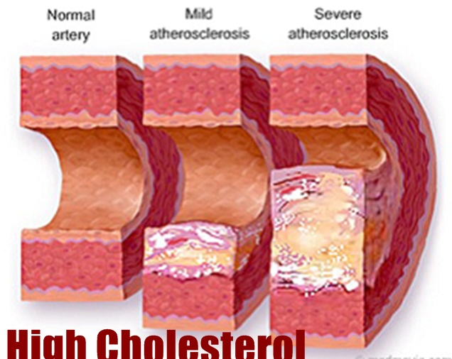 food high cholesterol avoid