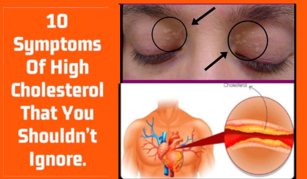 high cholesterol symptoms eyes